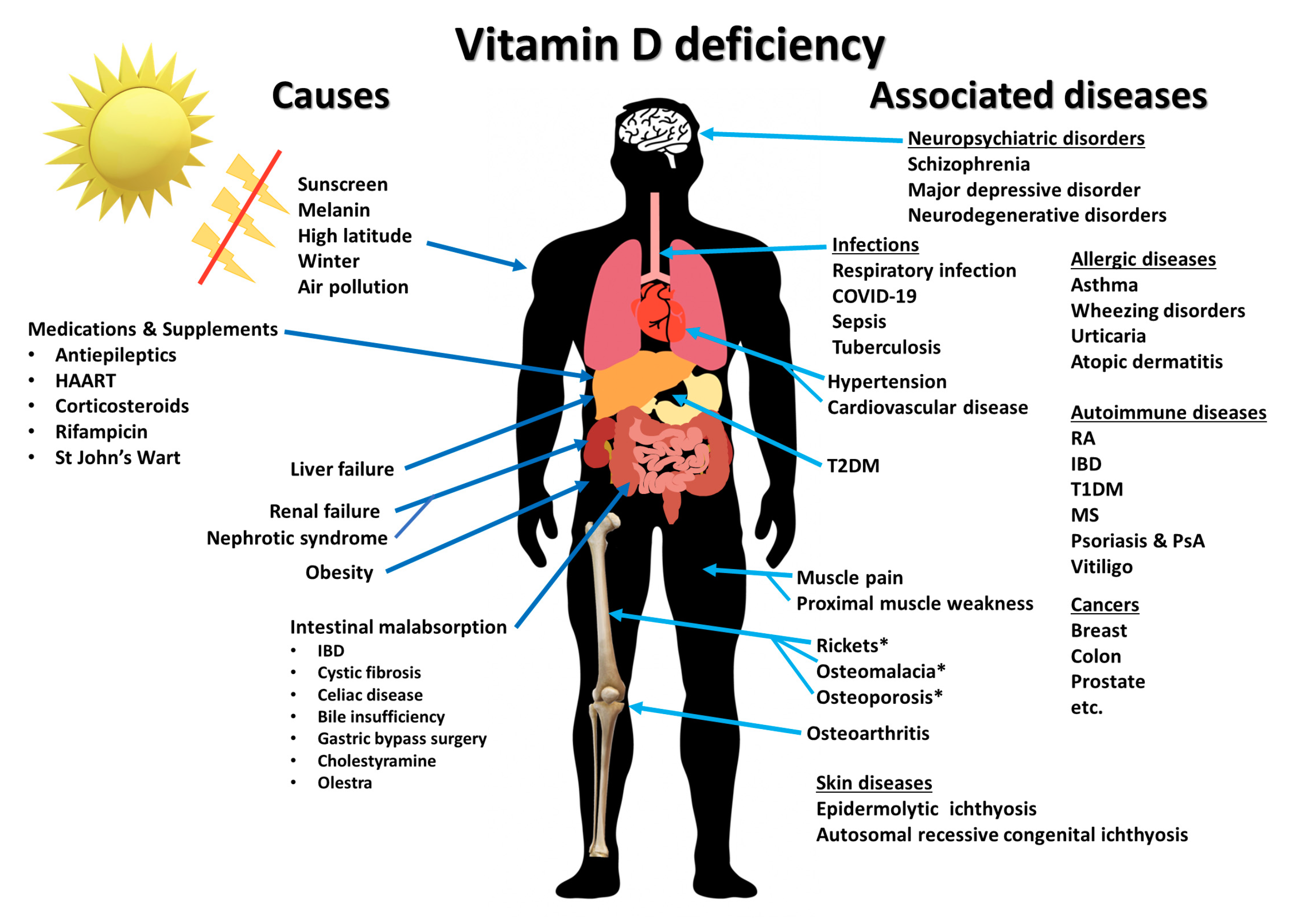☀️ VITAMINA D? ☀️ Fondamentale per Tutti!!!